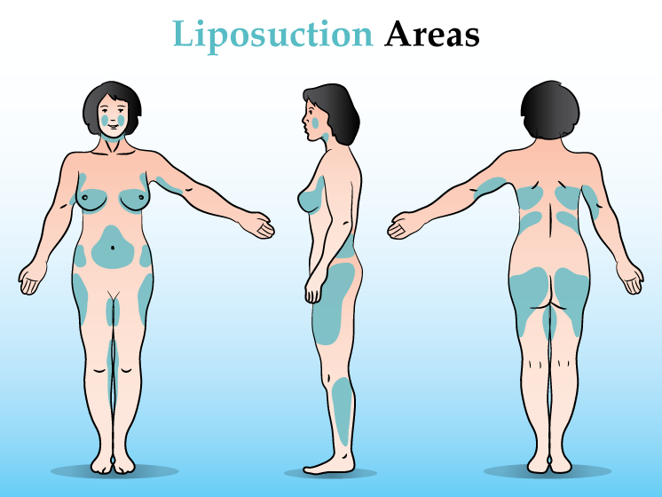 Best workout to lose weight and keep muscle photo 3