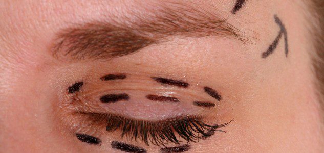 Eyelid Surgery Upper Lower Cost Recovery Time Etc