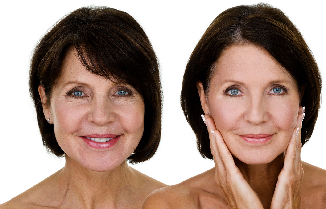 Cost of Facelift Surgery Benefits, Recovery, Results to Expect, etc