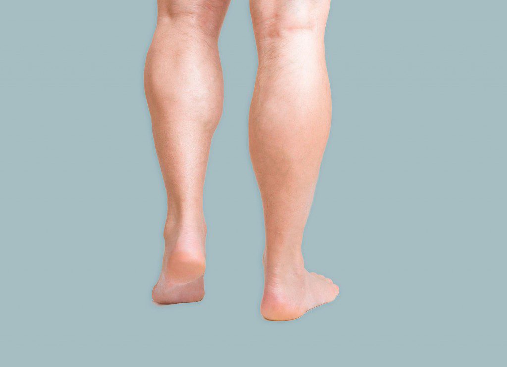 Calf Implants Increase Your Calves! Cost, Recovery, etc.