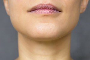 Chin Surgery (Mentoplasty)