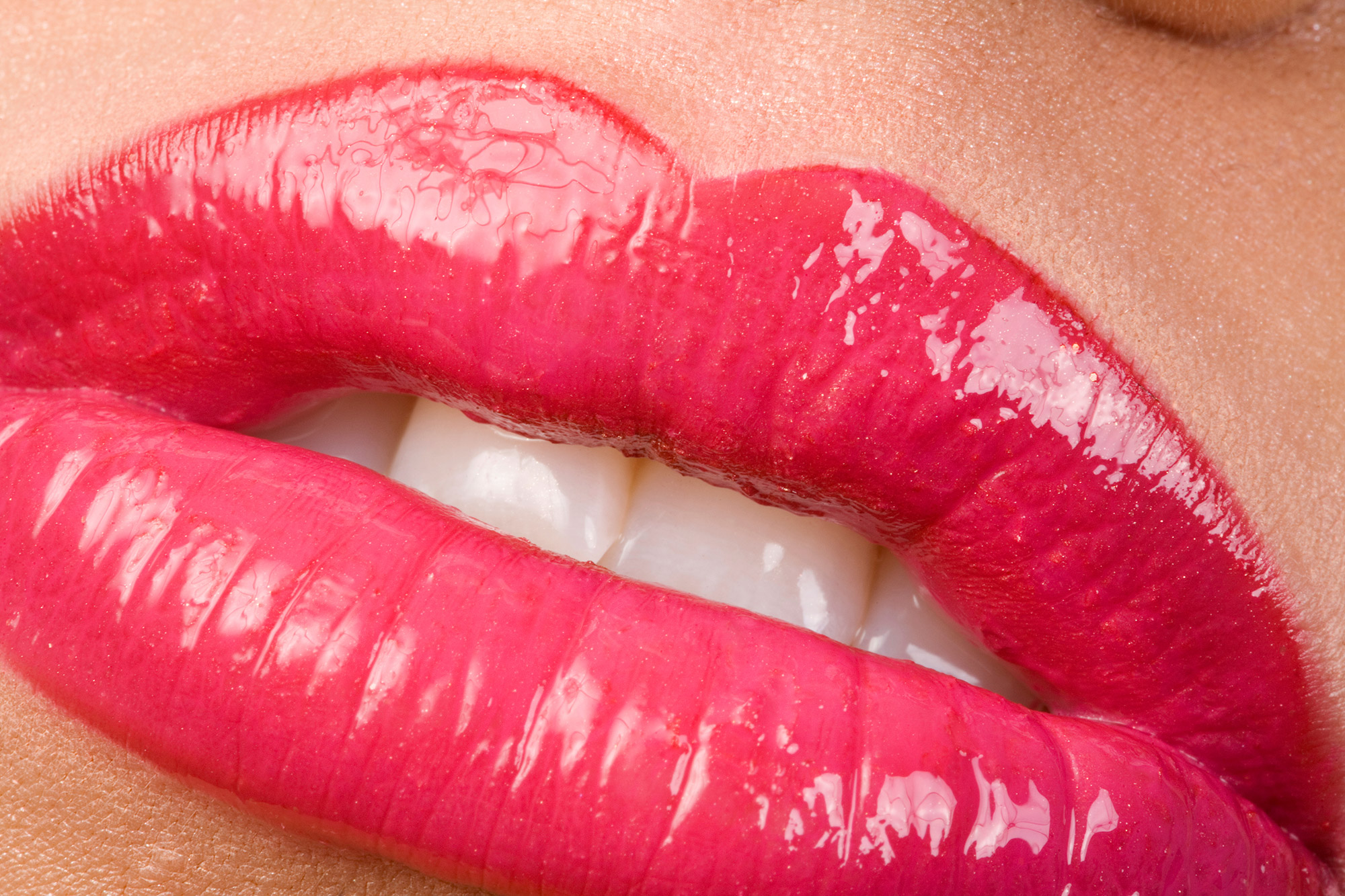 Lip Augmentation Cost, Treatment Options, Duration of Results