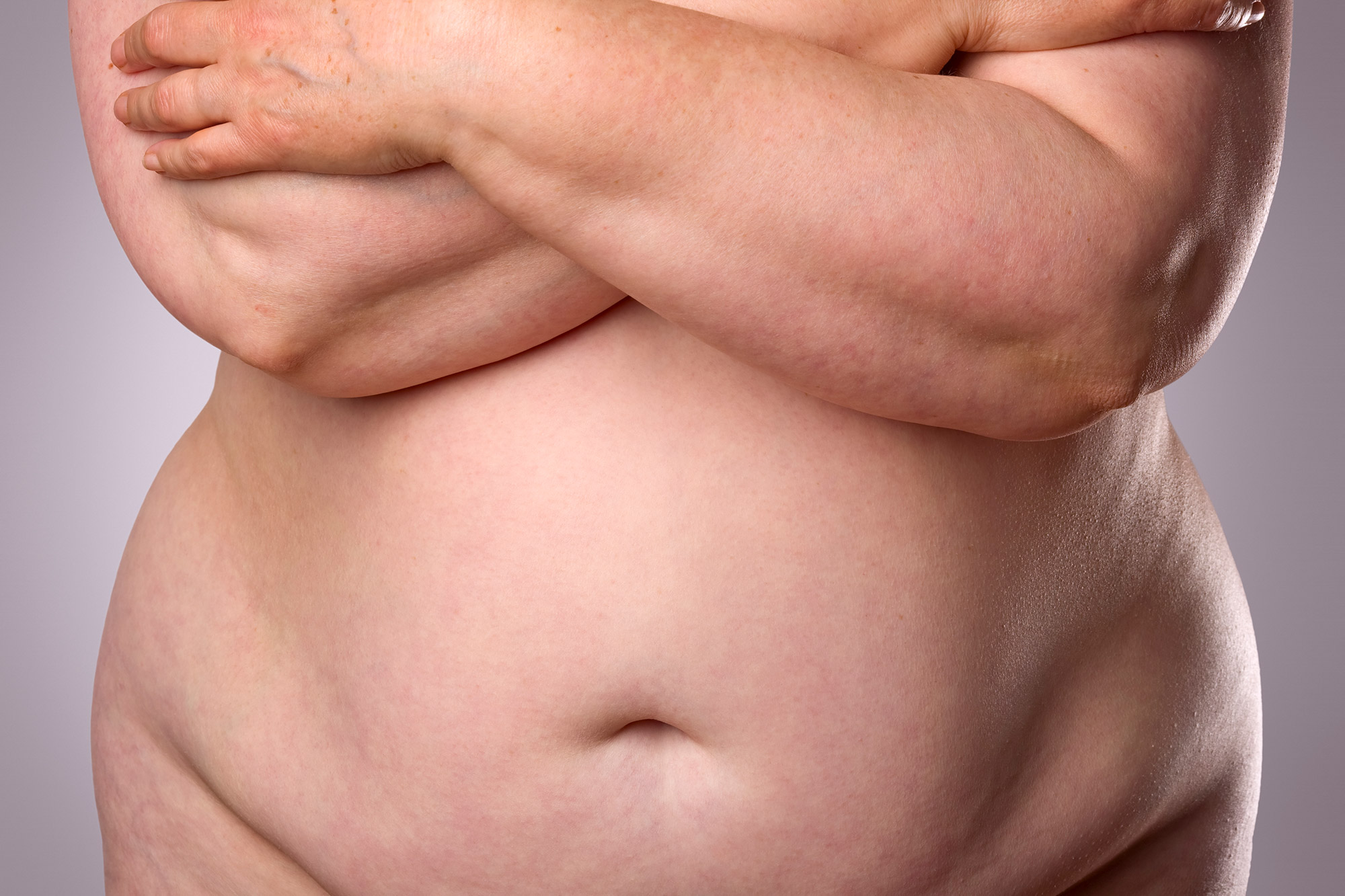 Pannus stomach (apron belly): Causes and how to reduce it