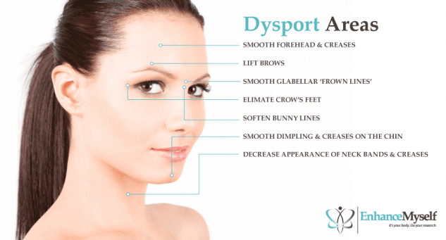 Areas that can be treated with Dysport® injections