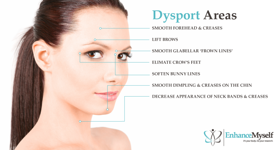 Cost of Dysport Injections vs. Botox, After Care, Final Results, etc.