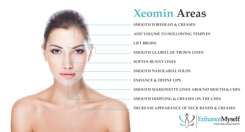 Xeomin Injections