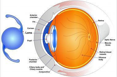 Intraocular Lenses IOLs
