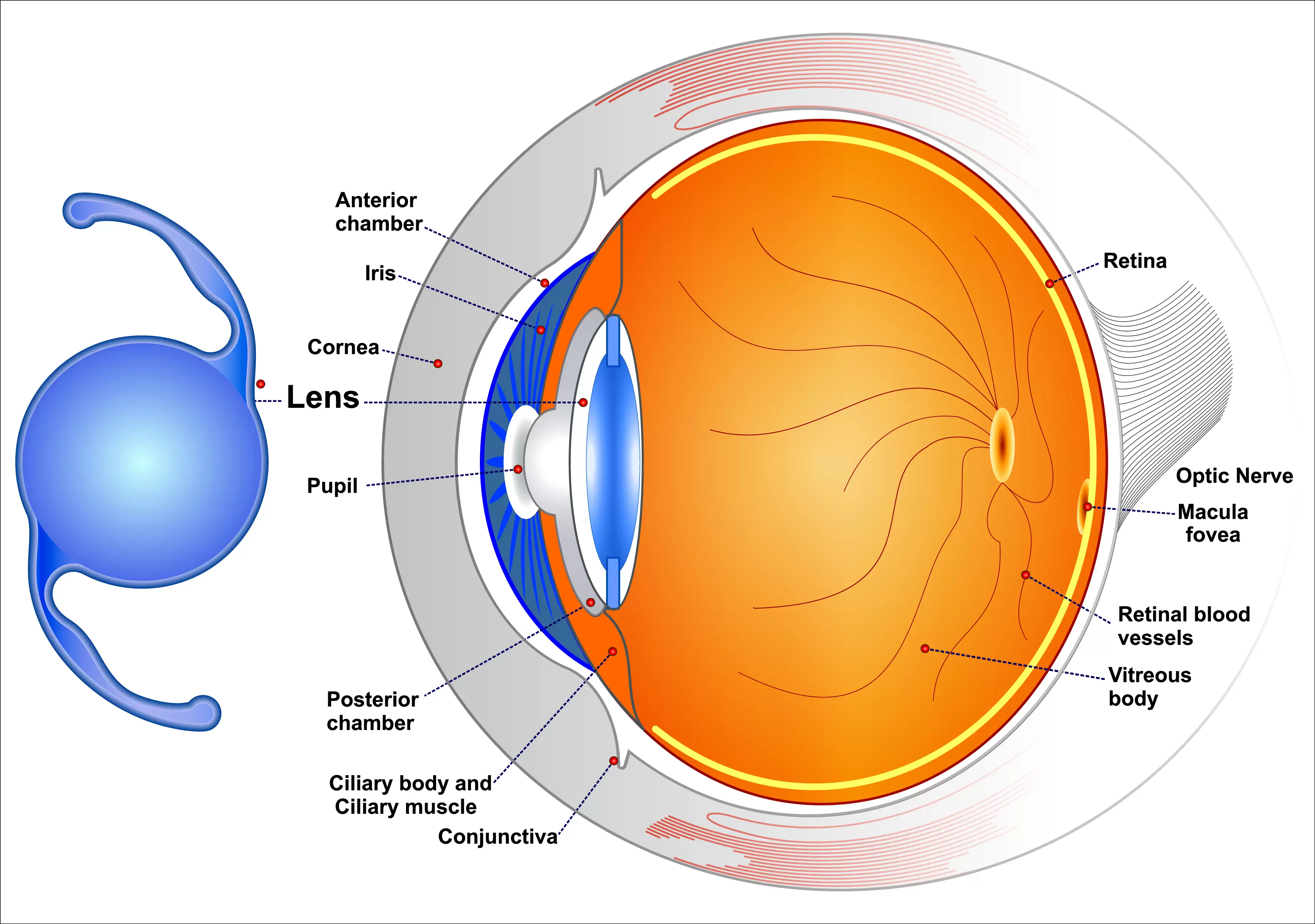 Intraocular Lenses IOLs