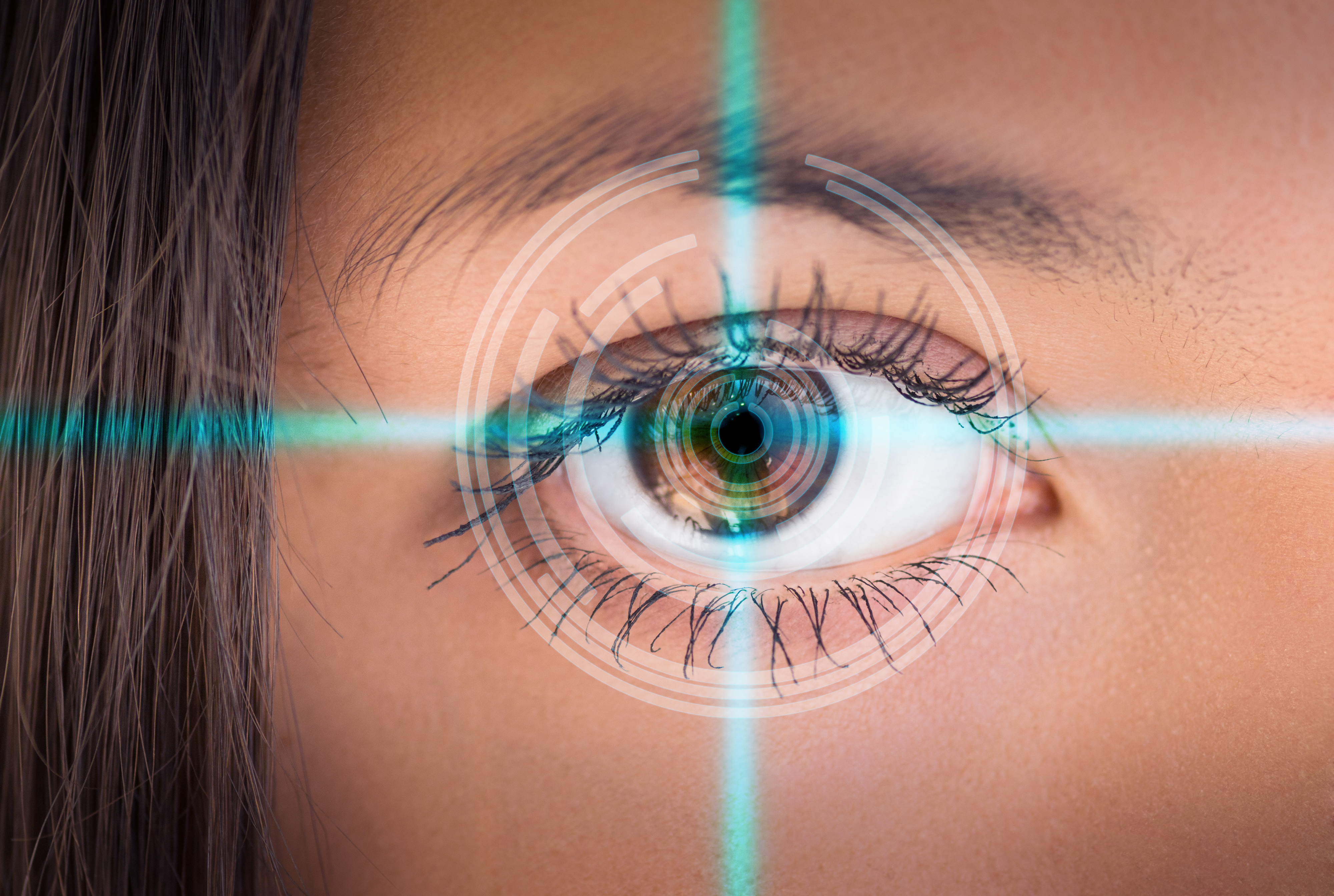 Intrastromal Corneal Ring Segments (INTACS)