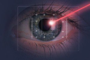 LASIK Eye Surgery