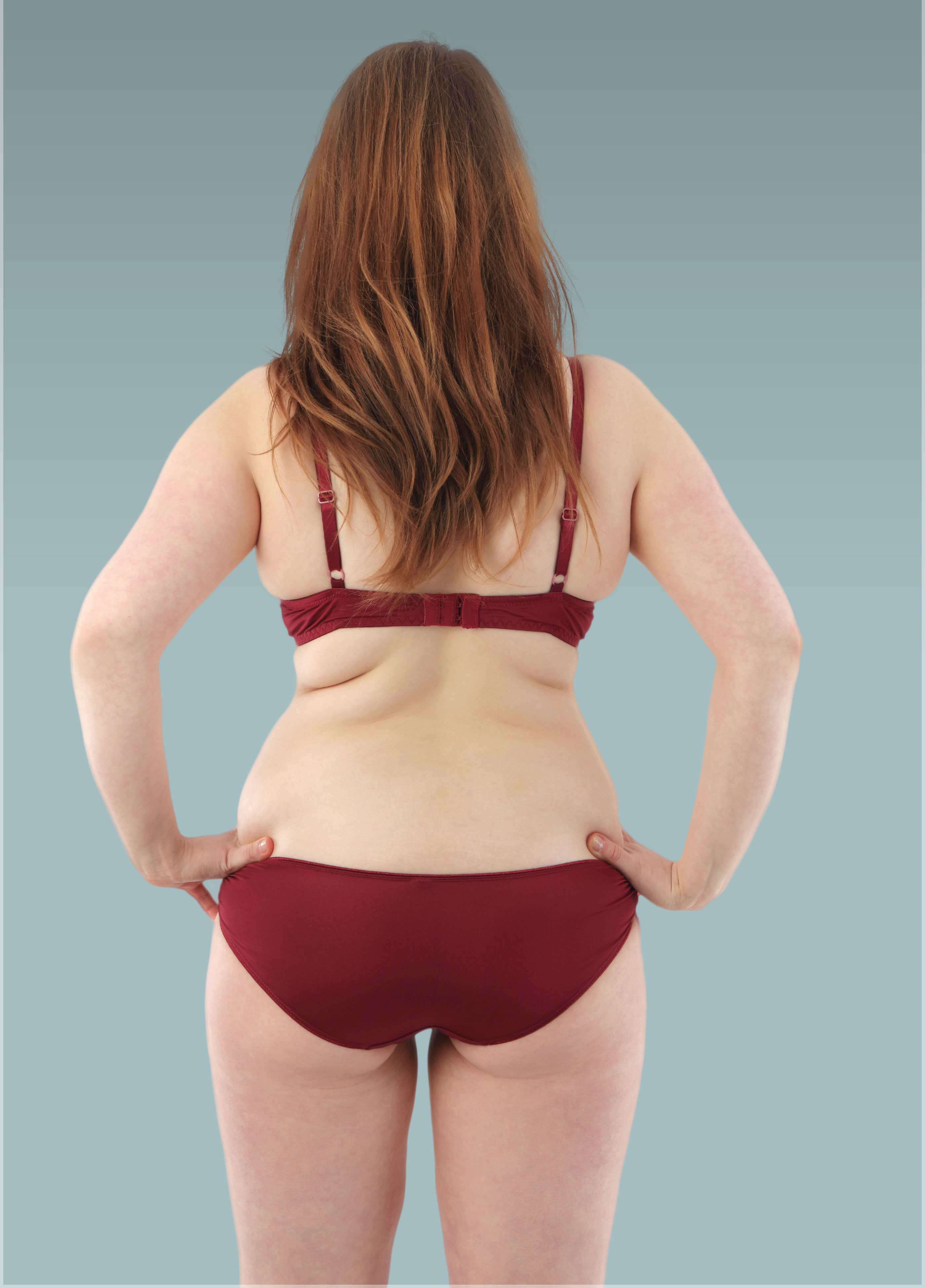 Bra Line Back Lift - Recovery, Risk and Cost Info - What to Know