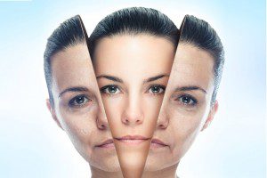 Laser Skin Resurfacing