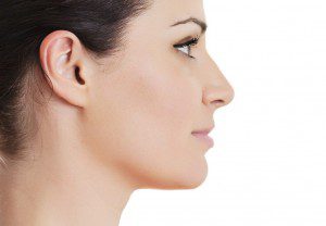 Kybella Injections